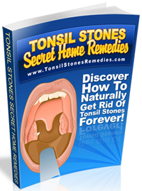 Tonsil Stones Secret Home Remedies